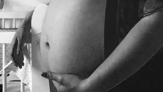 barriga1